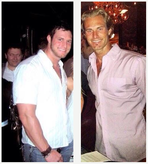 Ian M. M. Before and After #1