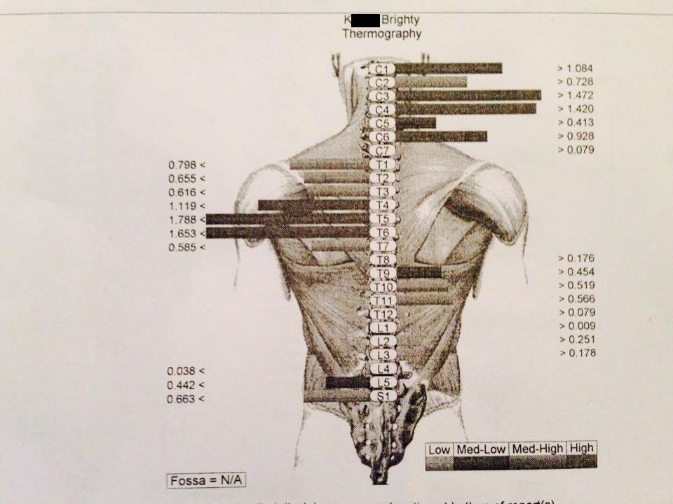 MyoVision Multiscan Report 1
