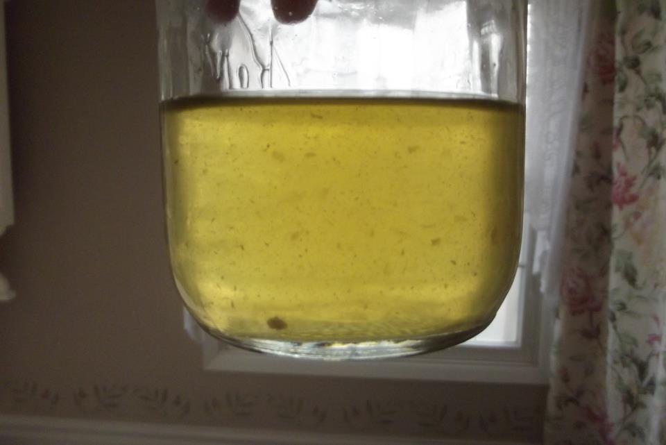 Urine Sediment #1