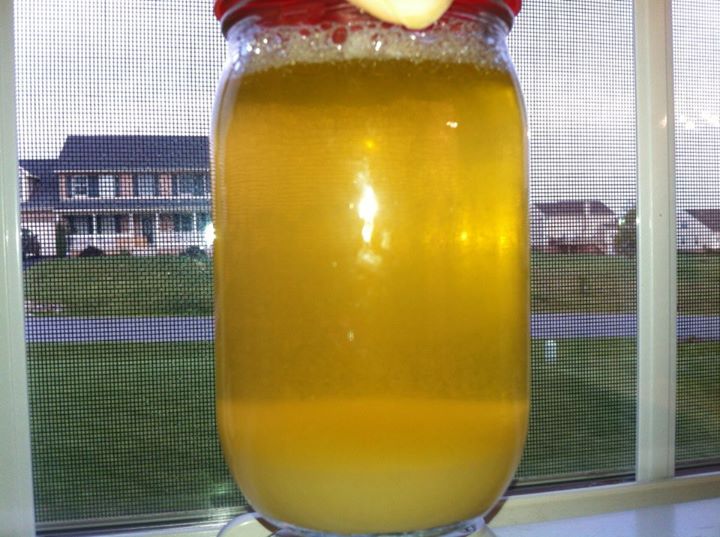 Urine Sediment #11