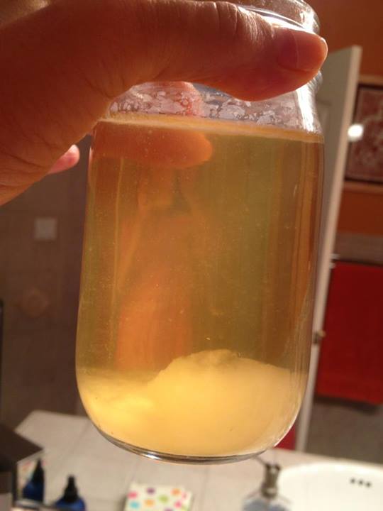 Urine Sediment #12