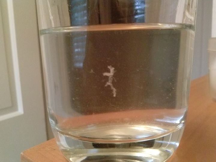 Urine Sediment #13