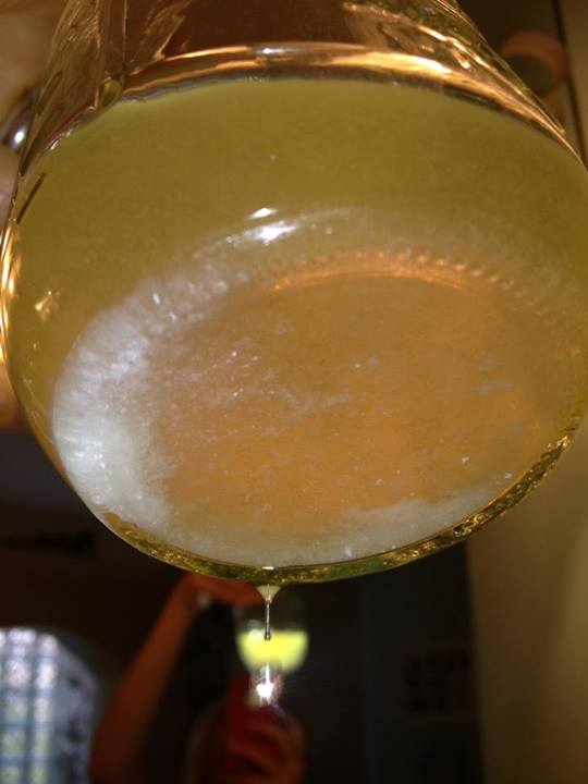 Urine Sediment #16