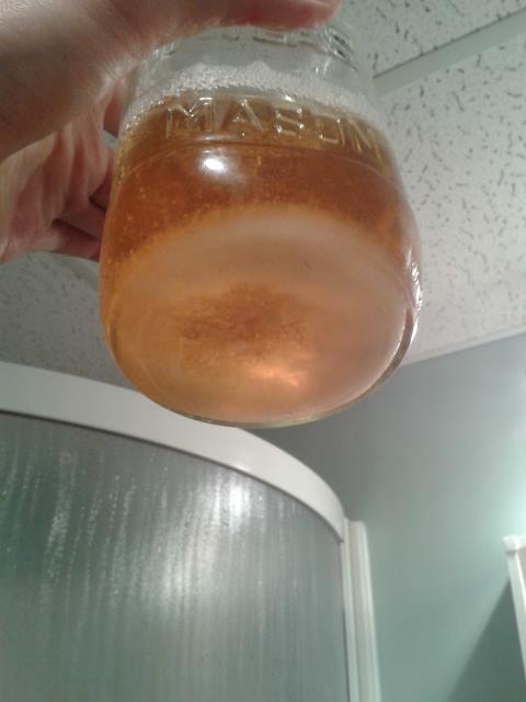 Urine Sediment #18