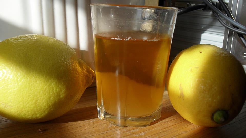 Urine Sediment #21