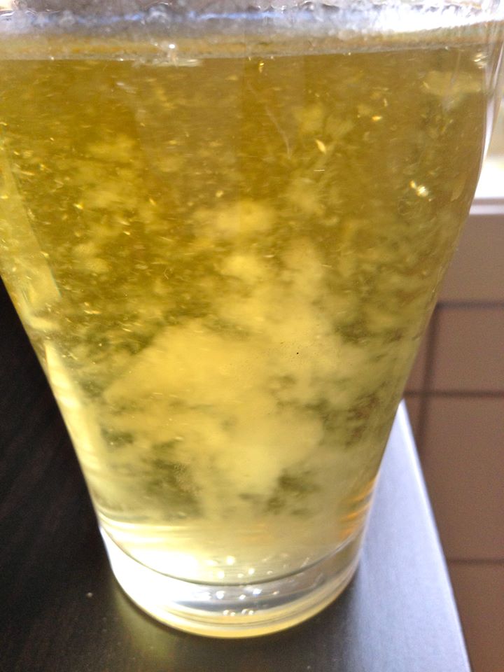 Urine Sediment #22 2