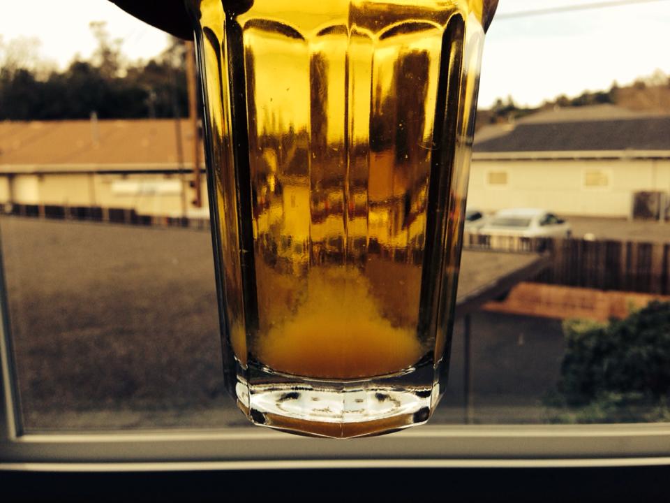 Urine Sediment #23 1