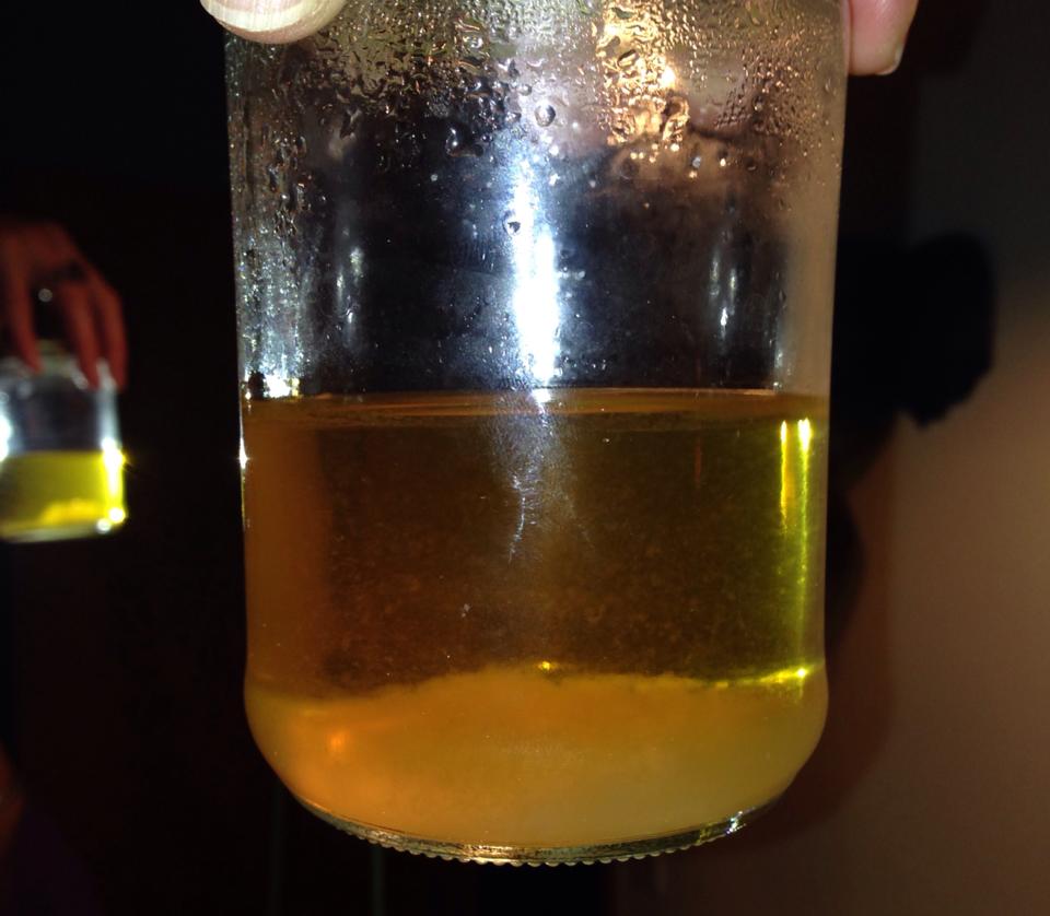 Urine Sediment #24