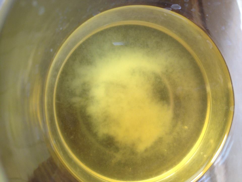 Urine Sediment #25 1