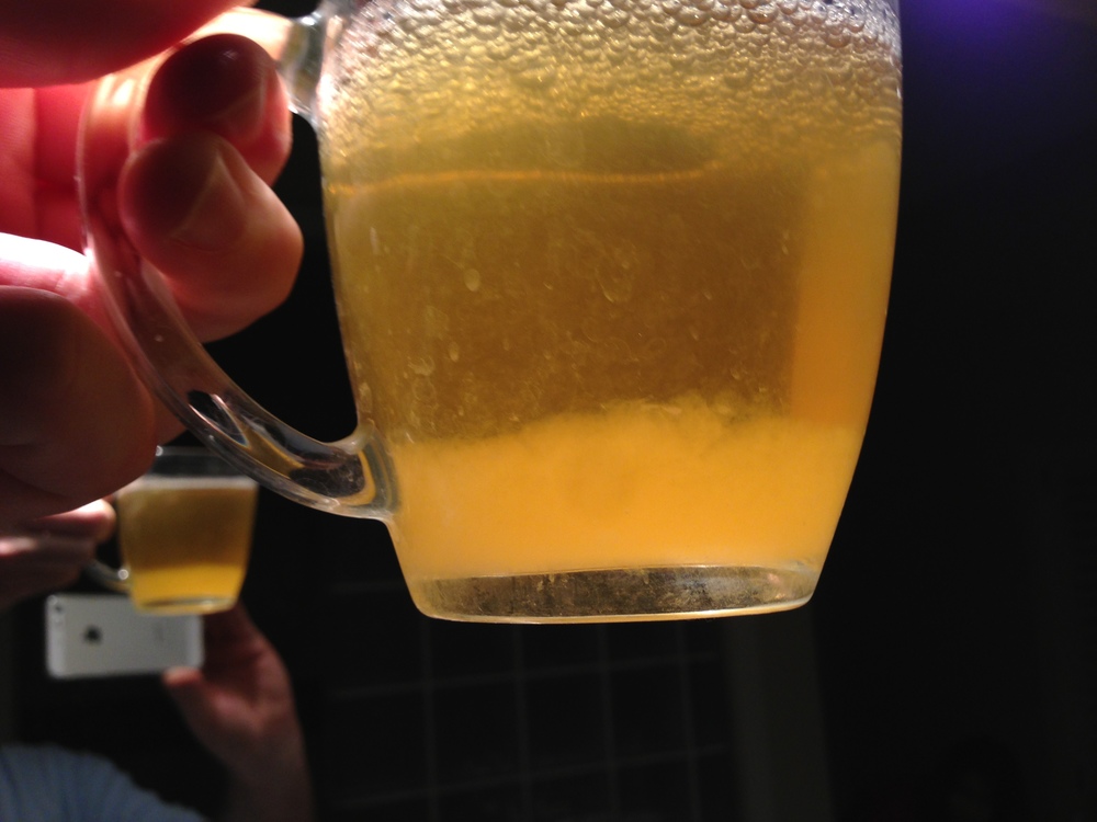 Urine Sediment #27
