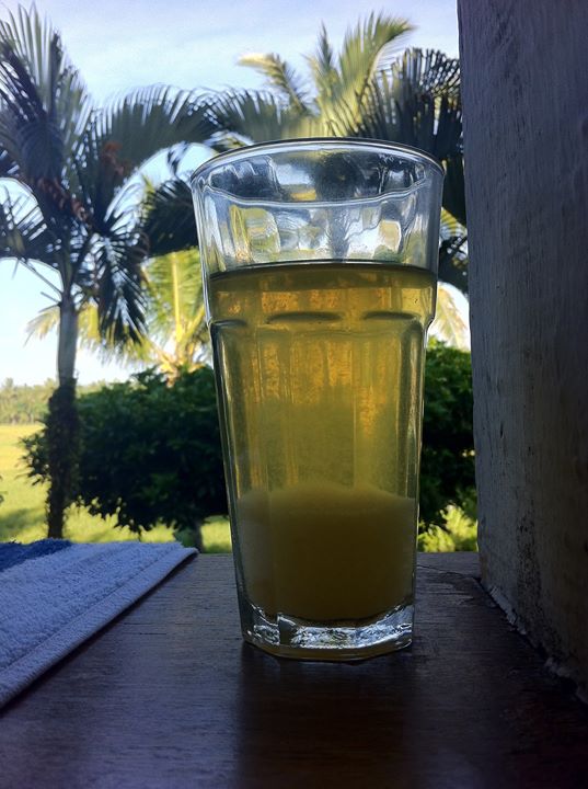 Urine Sediment #29 1