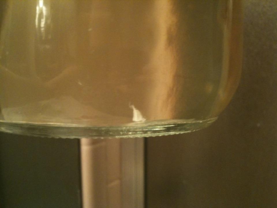 Urine Sediment #3