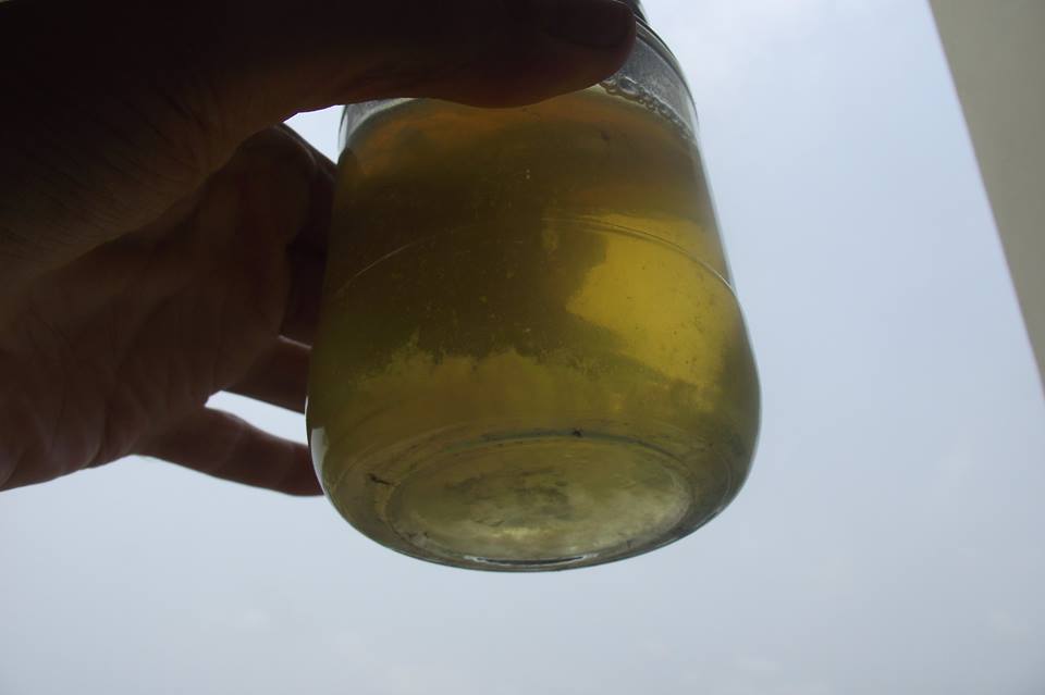 Urine Sediment #31 1
