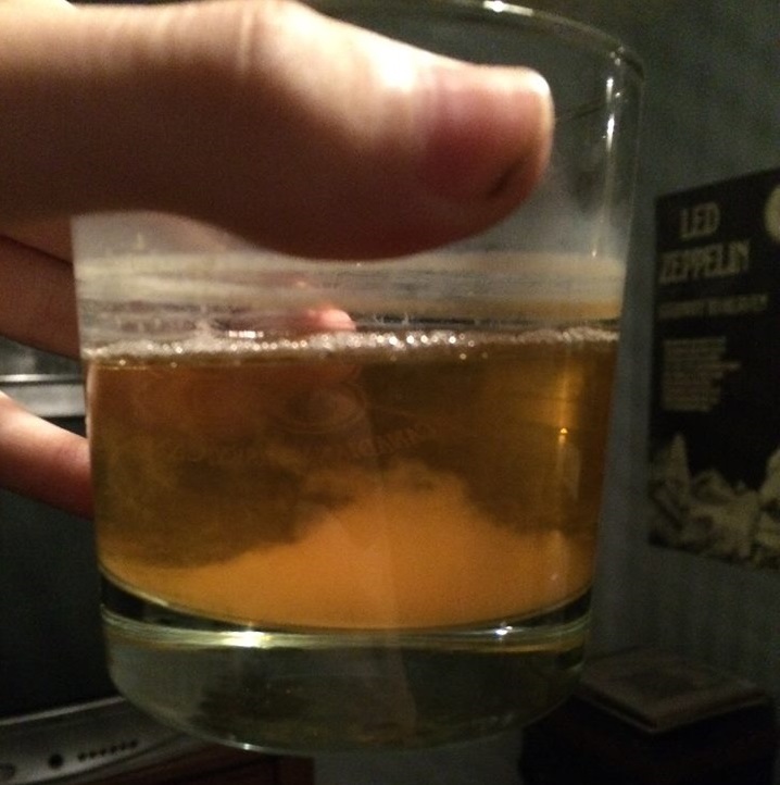 Urine Sediment #34