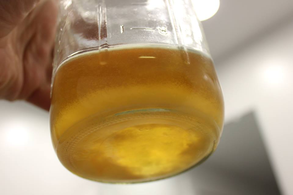 Urine Sediment #36