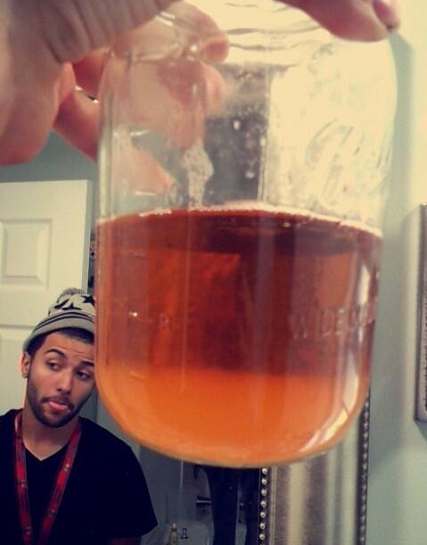 Urine Sediment #38