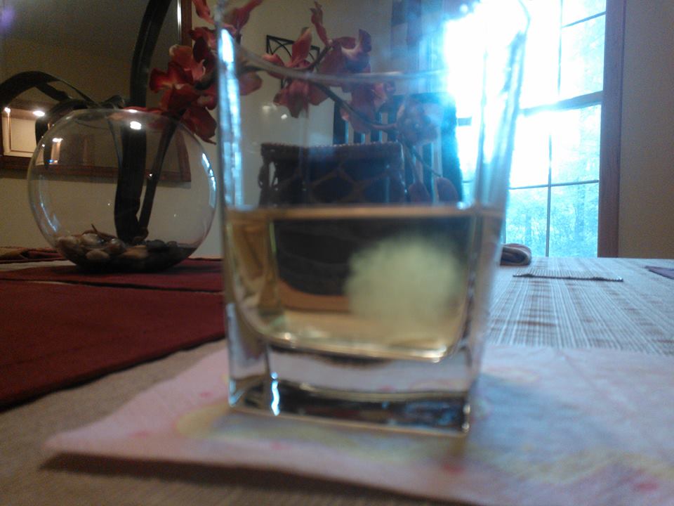 Urine Sediment #39