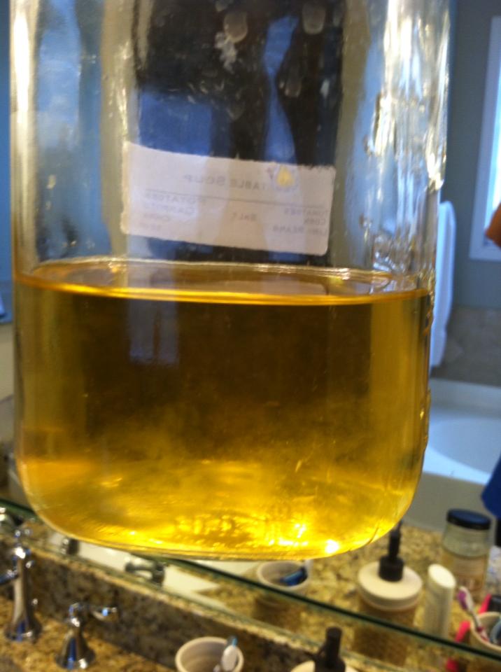 Urine Sediment #4