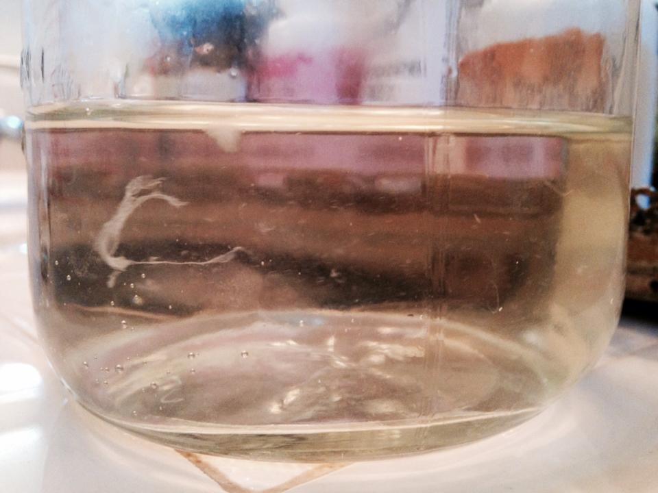 Urine Sediment #41 1