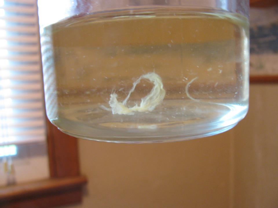 Urine Sediment #48 1