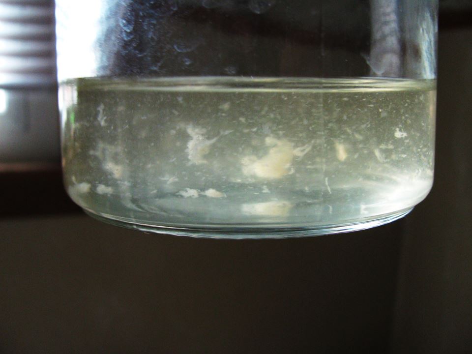 Urine Sediment #48 2