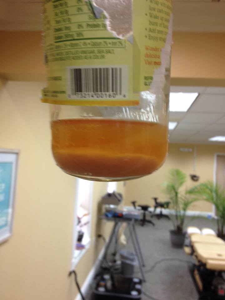 Urine Sediment #52