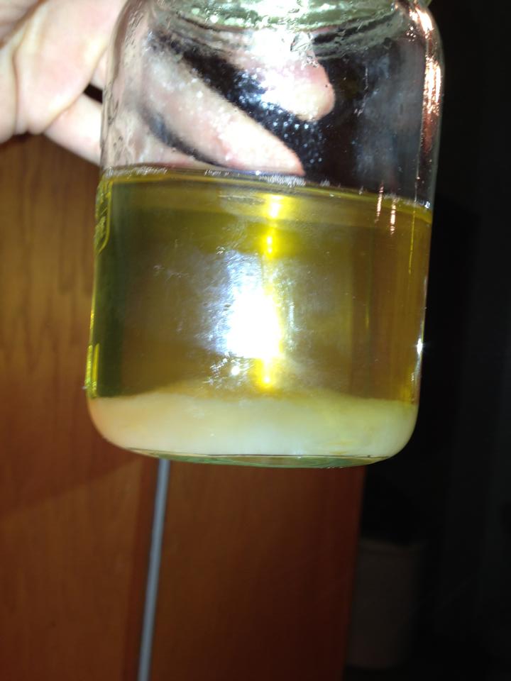 Urine Sediment #6