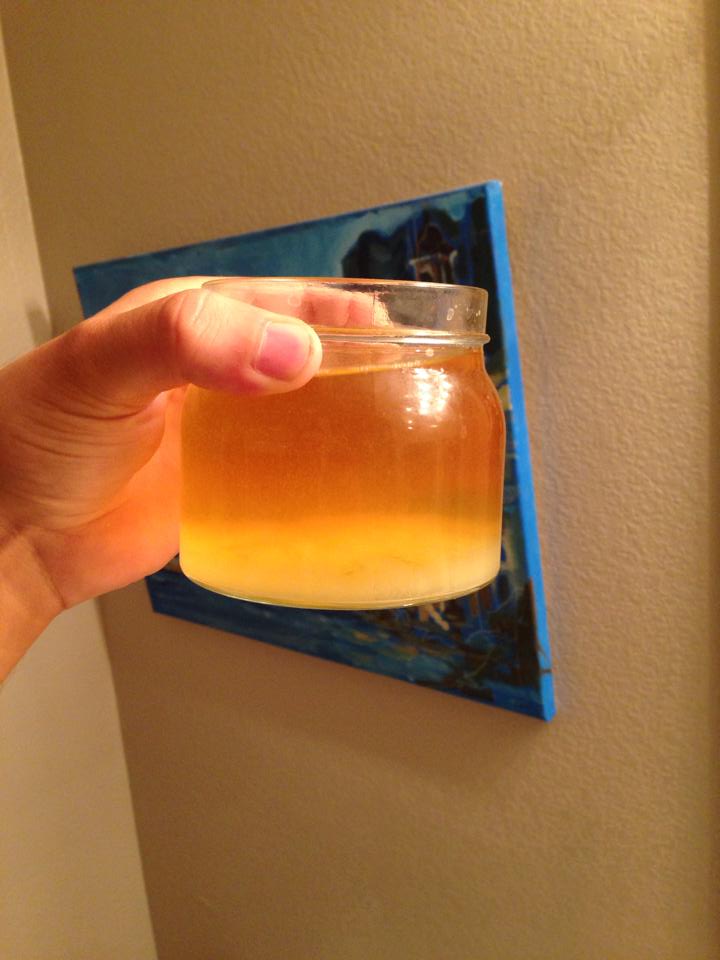 Urine Sediment #7