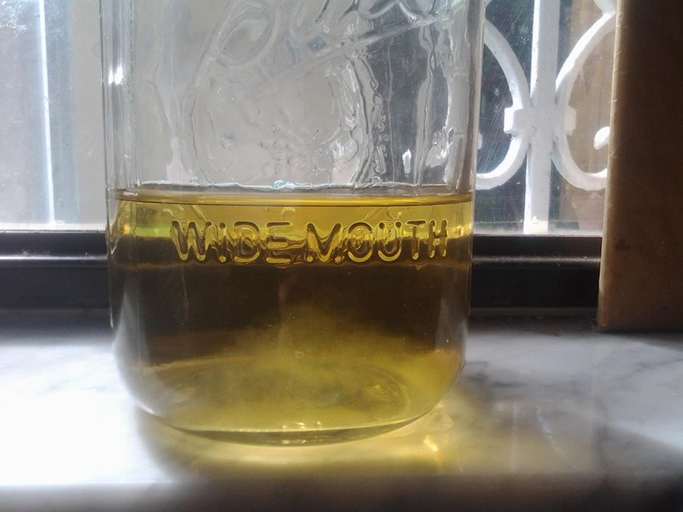 Urine Sediment #8