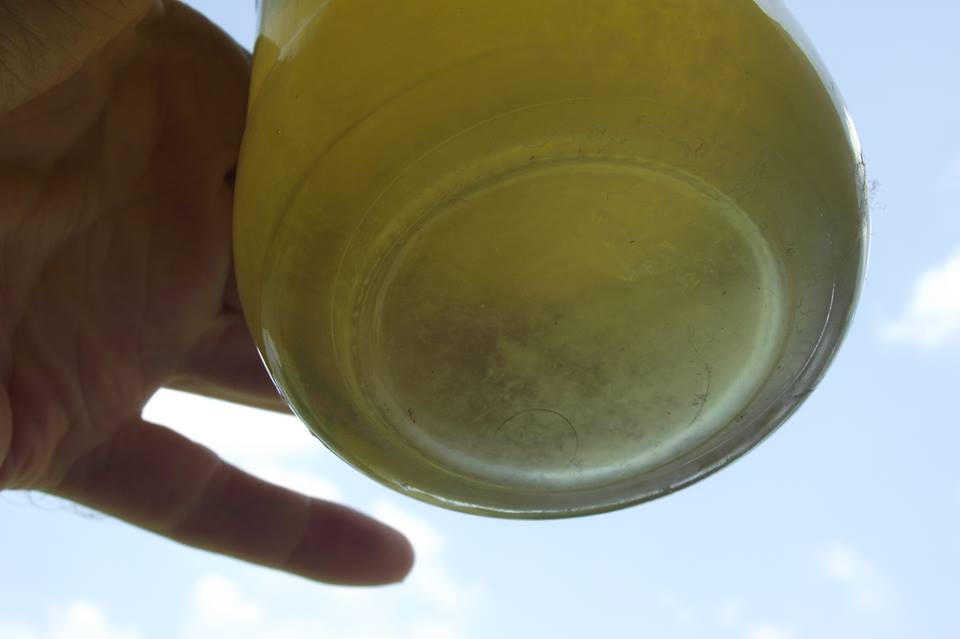 Urine Sediment #9