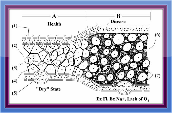 Dry, Healthy State vs. Wet, Diseased State II